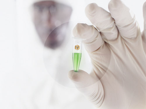 IMUBIND® Factor VIIa ELISA