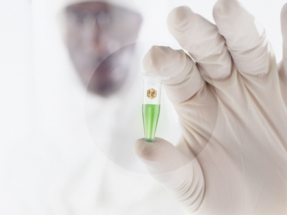 Factor X Deficient Plasma Immunodepleted