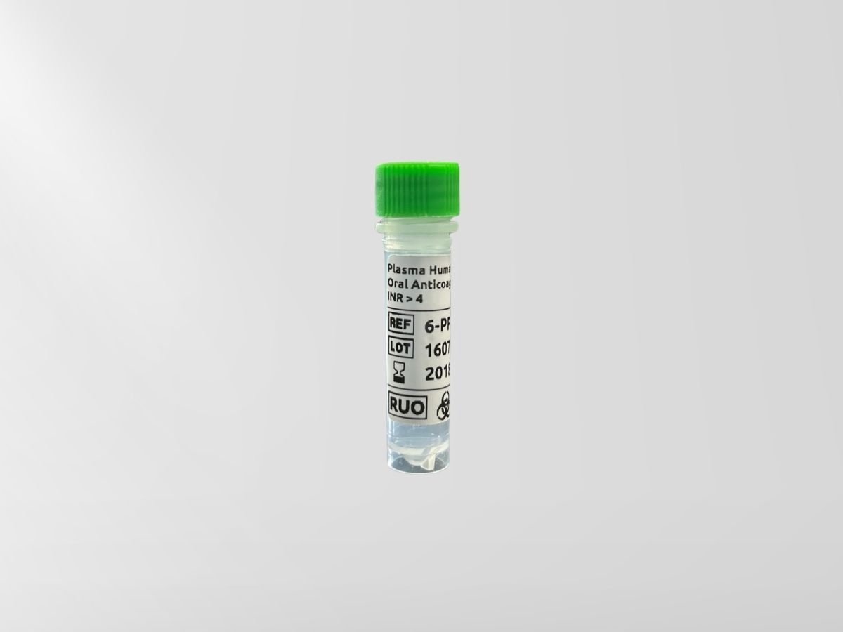 Plasma with oral anticoagulant plasma – INR ≥ 4.00