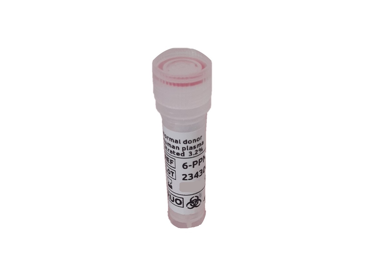 Normal donor citrated plasma (vol > 50mL)