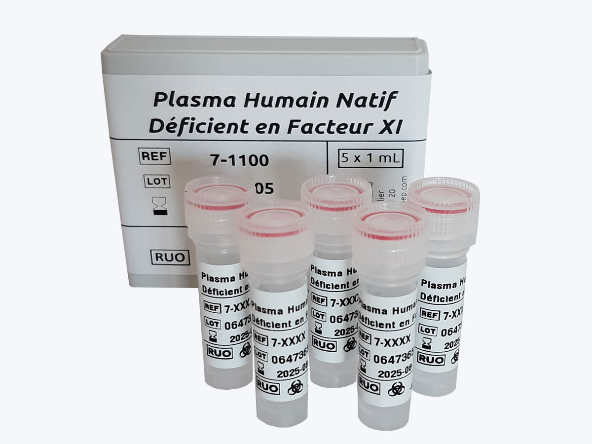 Human Factor XI congenital Deficient Plasma
