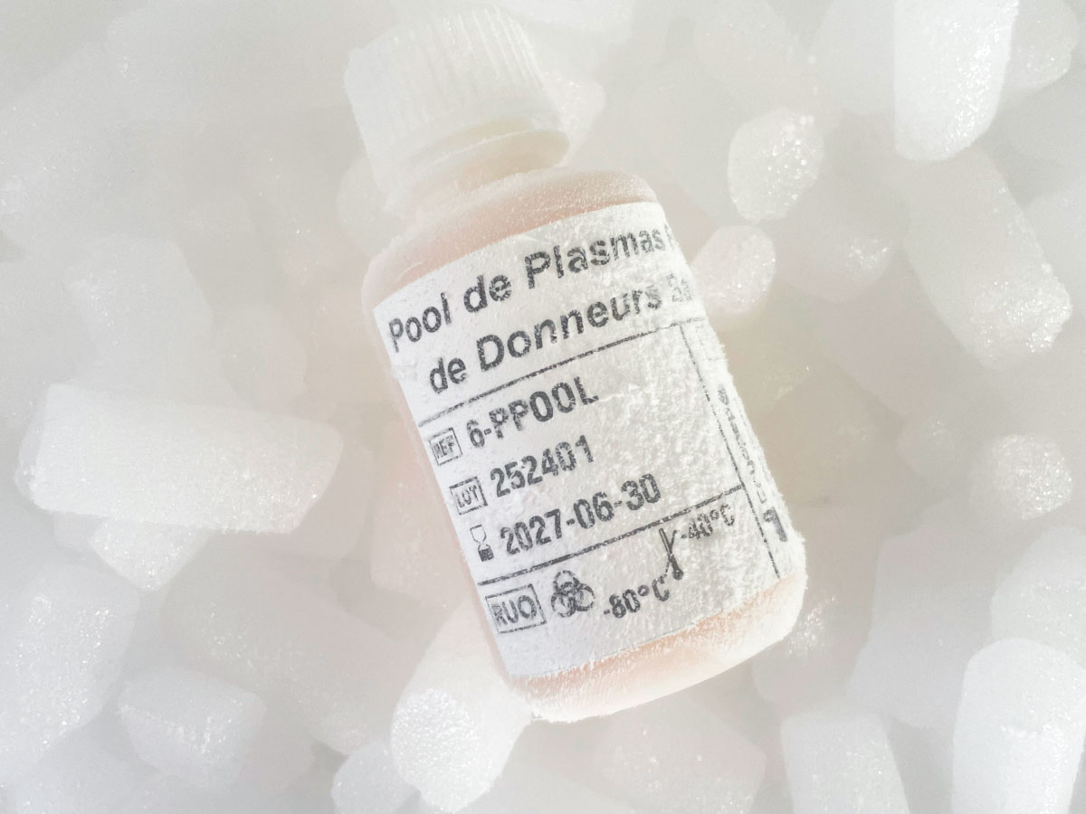 Pool of fresh plasma from healthy donors Pool of fresh plasma from healthy donors