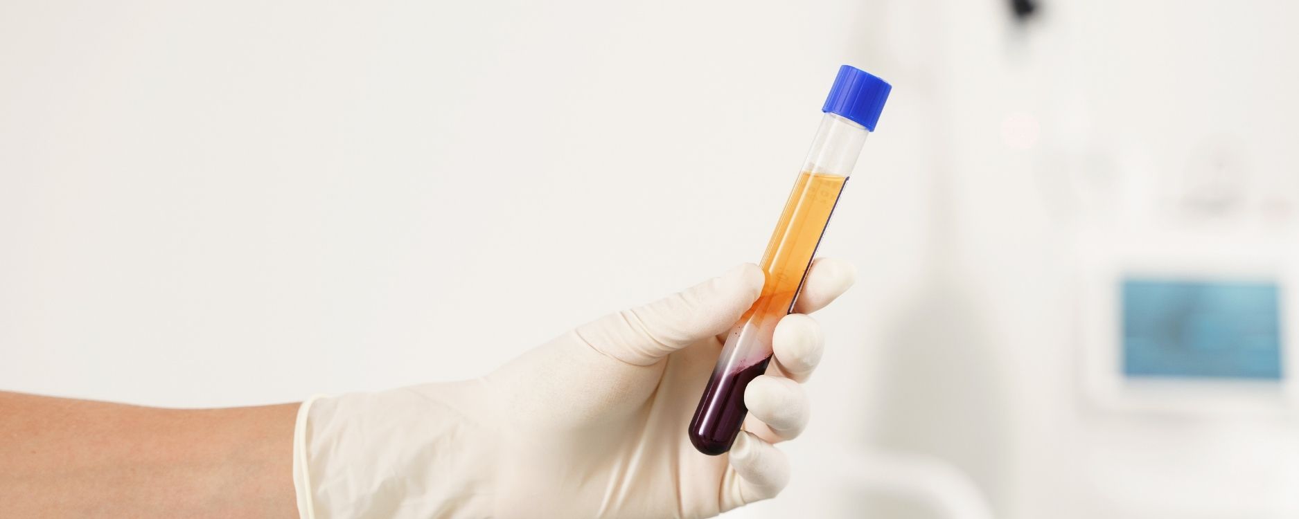 What is plasma ? 1 Quest ce que le plasma cryopep
