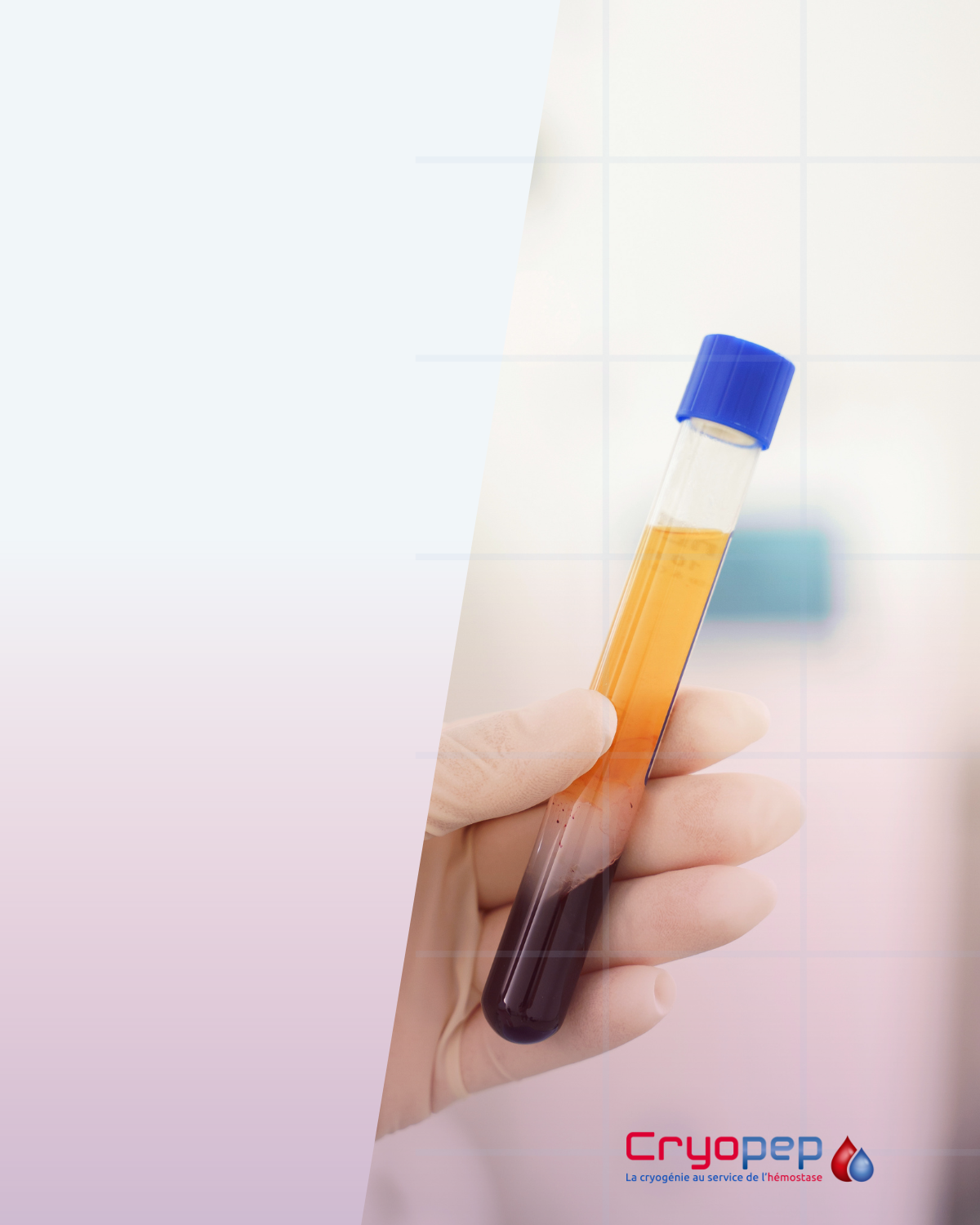 What is blood? 1 Quest ce que lhemostase 5